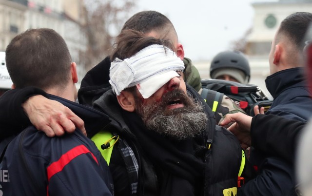 OPINION: France's 'yellow vest' conflict is heading into calamitous new territory